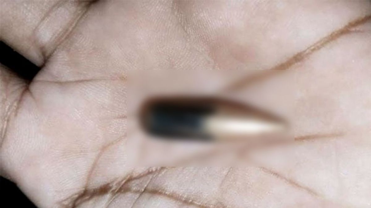 মিয়ানমার থেকে ছোড়া গুলিতে টেকনাফের নারী আহত