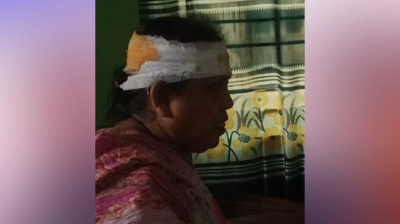 জামায়াতের নারী নেত্রীর ওপর রামদা দিয়ে হামলা