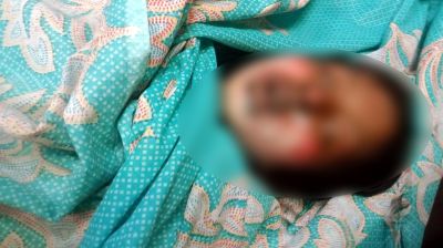 কুপ্রস্তাবে রাজি না হওয়ায় কিশোরীর গায়ে আগুন, অতঃপর মৃত্যু